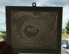 Load image into Gallery viewer, 3D Ultrasound Window Catcher

